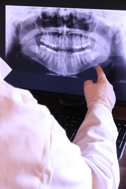 Best Emergency Dental Services for Seniors in Upland, PA